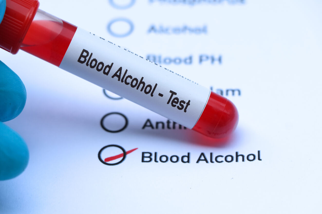 Blood Alcohol testing sample