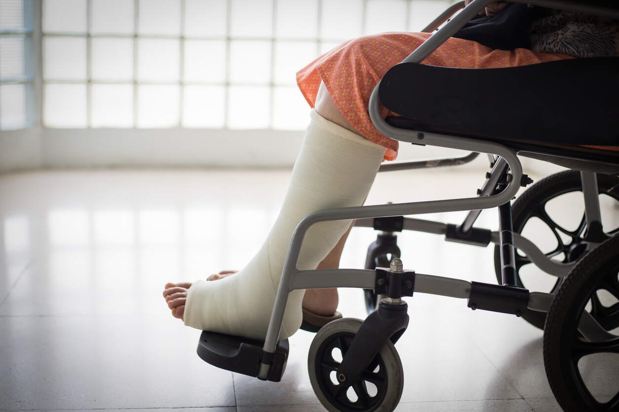 Person with a leg cast sitting in a wheelchair, illustrating complications from fractures that can lead to permanent injury.